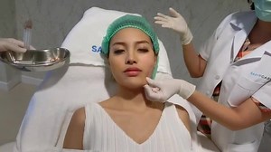 SARUNCARE CLINIC ร้อยไหมล็อค Stem Cell ยกหน้าให้ตึง ดึงให้ วีเชฟ 8 มิติ ✅มิติที่ 1 เป็นการยกกระชับใบหน้า ลดความหย่อนคล้อย ทำให้ใบหน้าดูเต่งตึงขึ้นชัดเจนหลังทำ ✅มิติที่ 2 ช่วยลดริ้วรอยและร่องลึก โดยเฉพาะในจุดที่ฟิลเลอร์และโบท็อกซ์ไม่สามารถจัดการได้ ✅มิติที่ 3 ปรับผิวให้เรียบเนียน เติมเต็มร่องแก้ม หลุมสิว รอยแผลเป็น ✅มิติที่ 4 ช่วยปรับผิวให้ขาว สว่าง กระจ่างใสมากขึ้น ✅มิติที่ 5 ปรับรูปหน้าให้ดู วีเชฟ แลดูอ่อนเยาว์ขึ้นชัดเจน ✅มิติที่ 6 กระตุ้นการสร้างคอลลาเจนที่ใต้ผิวชั้นลึก ✅มิติที่ 7 ด้วยเทคนิคพิ