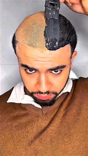 Cancer Took His Hair… This Trick Shocked Everyone 😲❤️#dhinchakviral #shorts