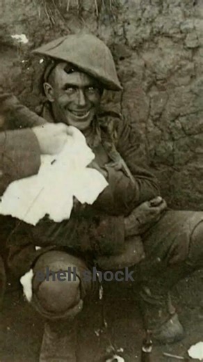 shell shock in ww1