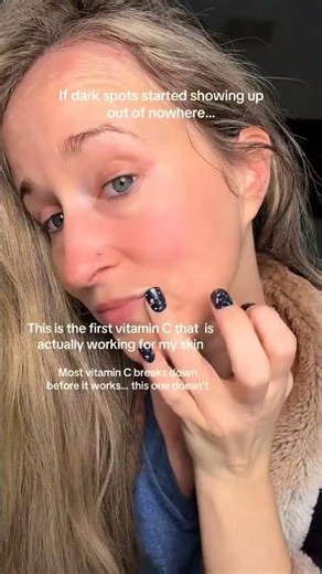 Dark spots and uneven skin tone don’t just disappear on their own