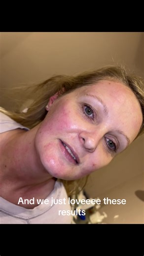 Forma Skin Tightening Treatments: Non-Surgical Solutions