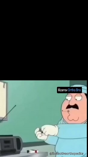 illustrative Ortho on Instagram: "Ex fix spine? No problem! External transpedicular fixation."