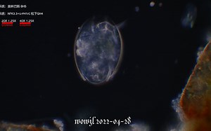 池塘水生物之九 urostyla 尾枝虫自爆（偏振和暗场）