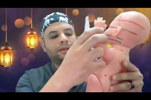 16K views · 534 reactions | Fetal urinary tract anomalies ultrasound - Dr. Mohamed Abdou | Radiology Courses | Facebook