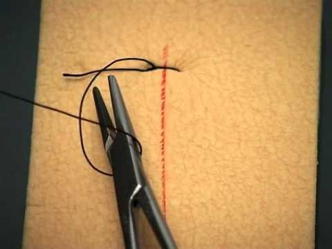 suture technique: Simple Suture