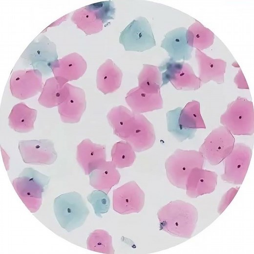 The Role of Membrane Filters in Liquid-Based Cytology