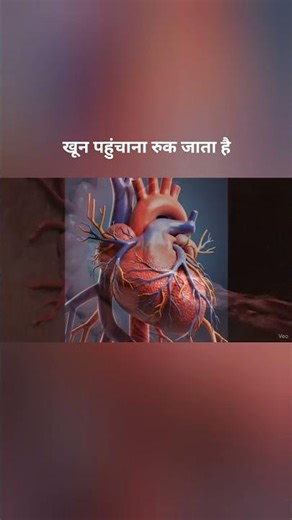 Heart Attack क्यों होता है? 3D Animation में सच जानिए!"