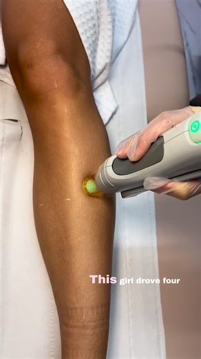 Full Body Laser for a £99 Membership 👛🩷 Start your laser journey at Laser 99, where you can get 8 full body laser sessions with an easy £99 instalment plan. ✔️ 8 sessions of full body laser ✔️ We use the Candela GentleMax Pro - the gold standard for fast, safe, effective results ✔️ Spread the cost with our £99 membership ✔️ Suitable for all skin types ...Which works out to just £173.25 per session! 📍 Peterborough – Maskew Avenue (behind Costa) Ready for smoother skin with no shaving, waxing o