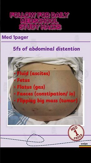 🔥5Fs of abdominal distention. ⚡Remember these #medicaleducation #med1pager #usmle #highyieldmedicine
