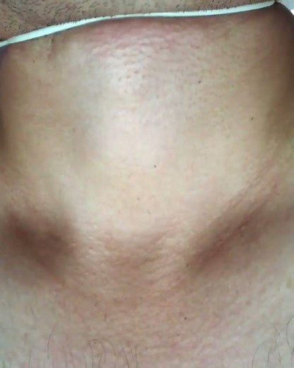 Choking cord ❤️✅