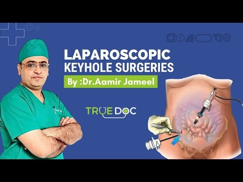 Treatment of Laparoscopic (Keyhole) Surgeries | Insights by Dr. Aamir Jameel