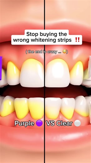 Avoid Common Mistakes with Teeth Whitening Products