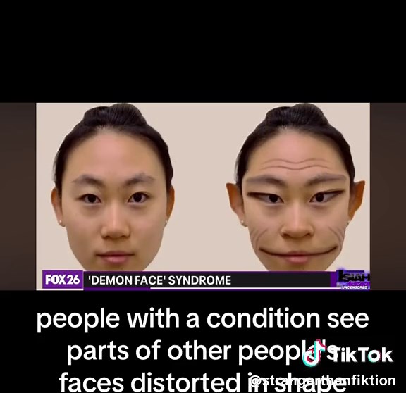 Understanding Demon Face Syndrome: Separating Illness from Reality