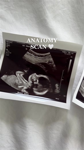 Incredible 21-Week Anatomy Scan of a Healthy Baby