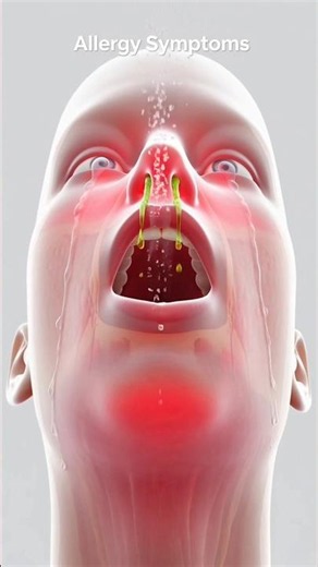 What Happens Inside Your Body During an Allergic Reaction? #science #facts