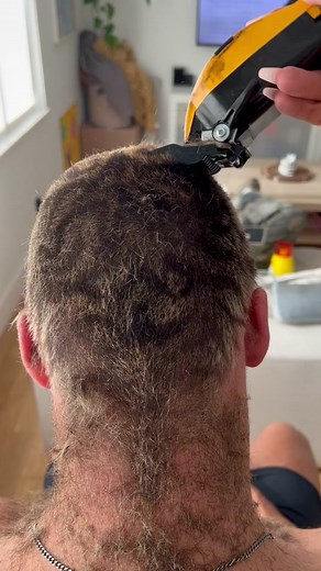 Hairiest neck ever seen in my life.