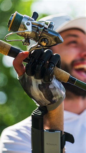 Meet the i‑Digits & i‑Limb! 🤩🦾 #LifeWithoutLimitations #ÖssurUpperLimb