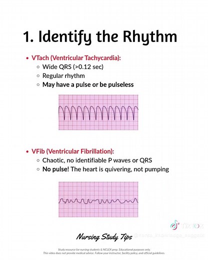 VFib vs VTach: Key Differences for Nurses