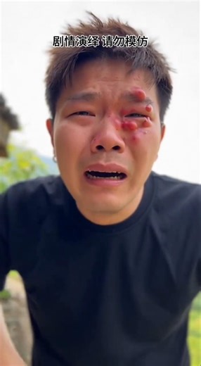 Wasp Attack Gone Wrong 😱🐝 | Epic Fail You Won’t Believe! #Shorts