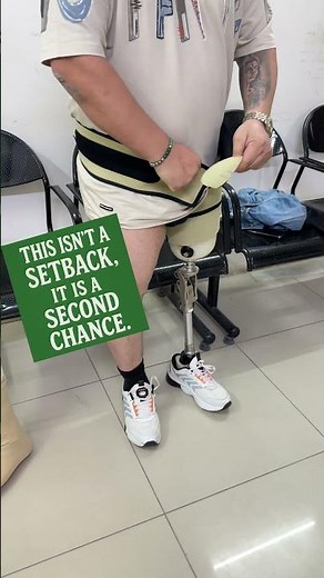 Above Knee Amputee Training & Effort 💪 #uniquerehabsolutions #artificialleg #abovekneeprosthesis