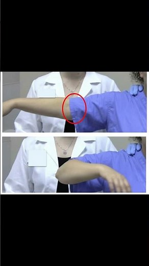 Gravity Varus Stress Test | Elbow Instability Check #elbowpain #physiotherapy #ATC #meded #ortho