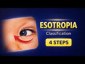 ESOTROPIA Classification Simplified (Step-by-Step Guide)
