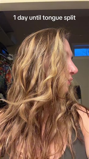 Tongue Splitting Journey: Day 5 Update and Insights