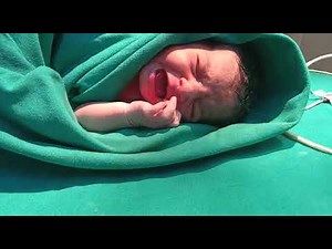 First cry of newborn baby.Crying response of newborn