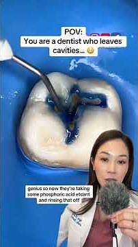 A clever way to go about filling a cavity. #cavity #cavities #dentist #cosmeticdentist #filling
