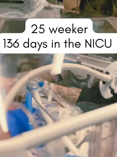 Born at 25 weeks weighing 1 lb 2 oz. Micro preemie strong 💪 #25weeker #micropreemie #micropreemiestrong #nicugraduate #nicustrong