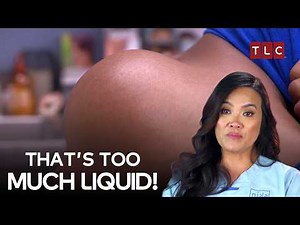 Dr Sandra Lee Pulls Out a Full Litre of Fluid | Dr Pimple Popper S2 E14