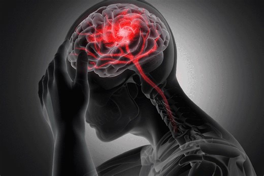 What causes common headaches and migraines? Experts think they finally know
