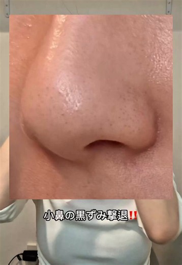パーフェクトワンフォーカスって日本の製薬会社が作ってるスキンケアブランドだから研究技術すっっっごいよね。1番新しいバームは毛穴汚れを落とすのは当たり前で、汚れを作らせないっていう次元。他社のクレンジングよりも一歩先を歩いてるブランドだと思う