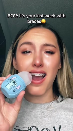 Her Teeth Are Going To Fall Out?! 🦷😳🫣 #fyp #teeth #dentistry #braces #health #reaction