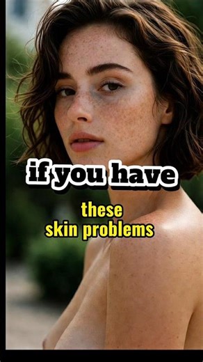 Do you have these skin problems? Try this 🎀 #skincare #youtubeshorts