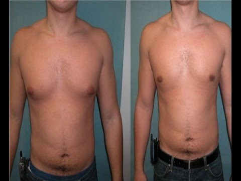 how to get rid of moobs fast at home