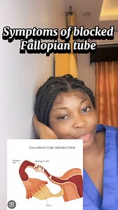 Symptoms of blocked fallopian tube. #blockedtube #blockedtubestreatment #falliopiantubeblock | Giftfavour’world