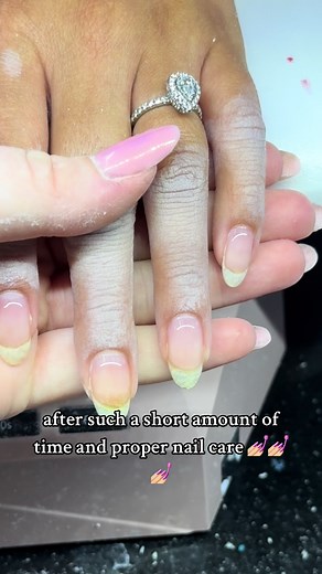 NO MORE RINGS OF FIRE ❌🔥💅🏼#nailtech #nailspo #nailtiktok #nailtok #nailinspo #rubberbase #rubberbasegel #rubberbasenails #naturalnails #valentinobeautypure #beautypure #valentinonails #valentino #nails #nudenails #privatenailtech #kentucky #emotionalsupportnecklace #naturallook #ringsoffire #ringoffire #trendingnails