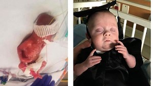 Hospital hosts graduation for NICU baby