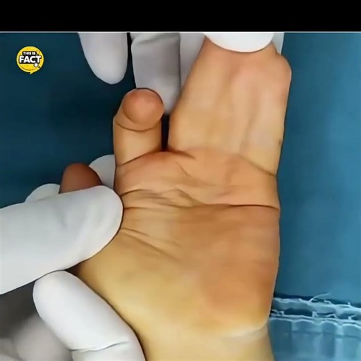 This Rare Condition Will Surprise You!😱