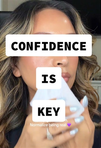 Embrace Confidence Beyond Melasma With Makeup Tips