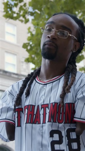 I was born without arms and one leg ❤️ #fbreels #borndifferent #limbdifference #disabilityawareness #contentcreator | Born Different