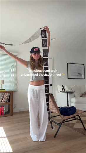 Baby Boy's Picture Day: 20-Week Scan