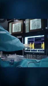 What is An Ablation and How Does it Treat Atrial Fibrillation (AFib)?