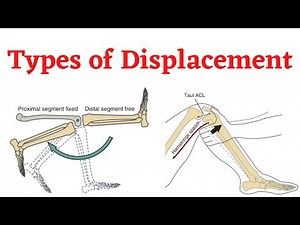 Biomechanics. Kinematic Variables (Part 1). Types of Displacement/motion.
