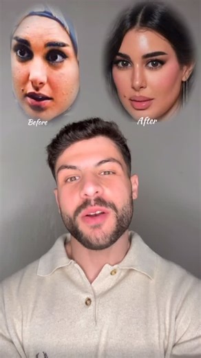 Dr.Ahmed Nagy on Instagram‎: "تعالوا نعرف إزاي ياسمين صبري حلوة كده 😍✨ Lets find out how Yasmin Sabri looks this beautiful!! Watch the video for more details 👀 DM us to book your appointment📩 #dr_ahmed_nagy #eyebrow_lifting #chin_filler #jawline_filler #forehead_botox"‎