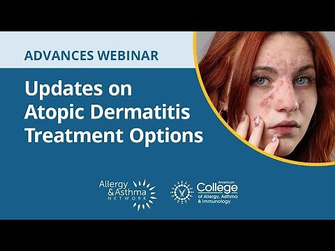 Updates on Atopic Dermatitis Treatment Options and the Role of Biologics
