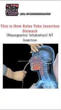 This Is How Doctors Insert a Tube into the Stomach | Educational Demo #medicalshorts