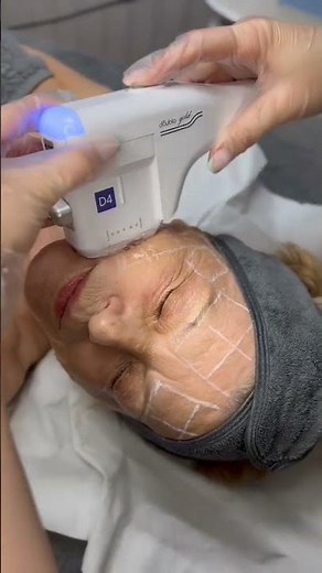 Radio Frequency and HiFu combination Treatment - Clinicbe #rf #hifu #clinicbe #skin #antiaging