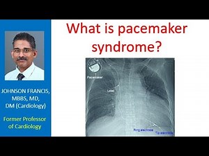 What is pacemaker syndrome?